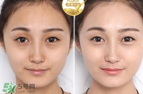 �۲���׸��ĸ����Ӻã��۲���׸��Ƽ�